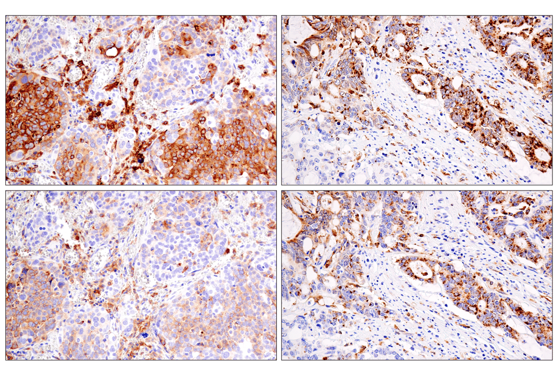 Immunohistochemistry Image 7: HLA-DRA (E9R2Q) Rabbit Monoclonal Antibody (BSA and Azide Free)