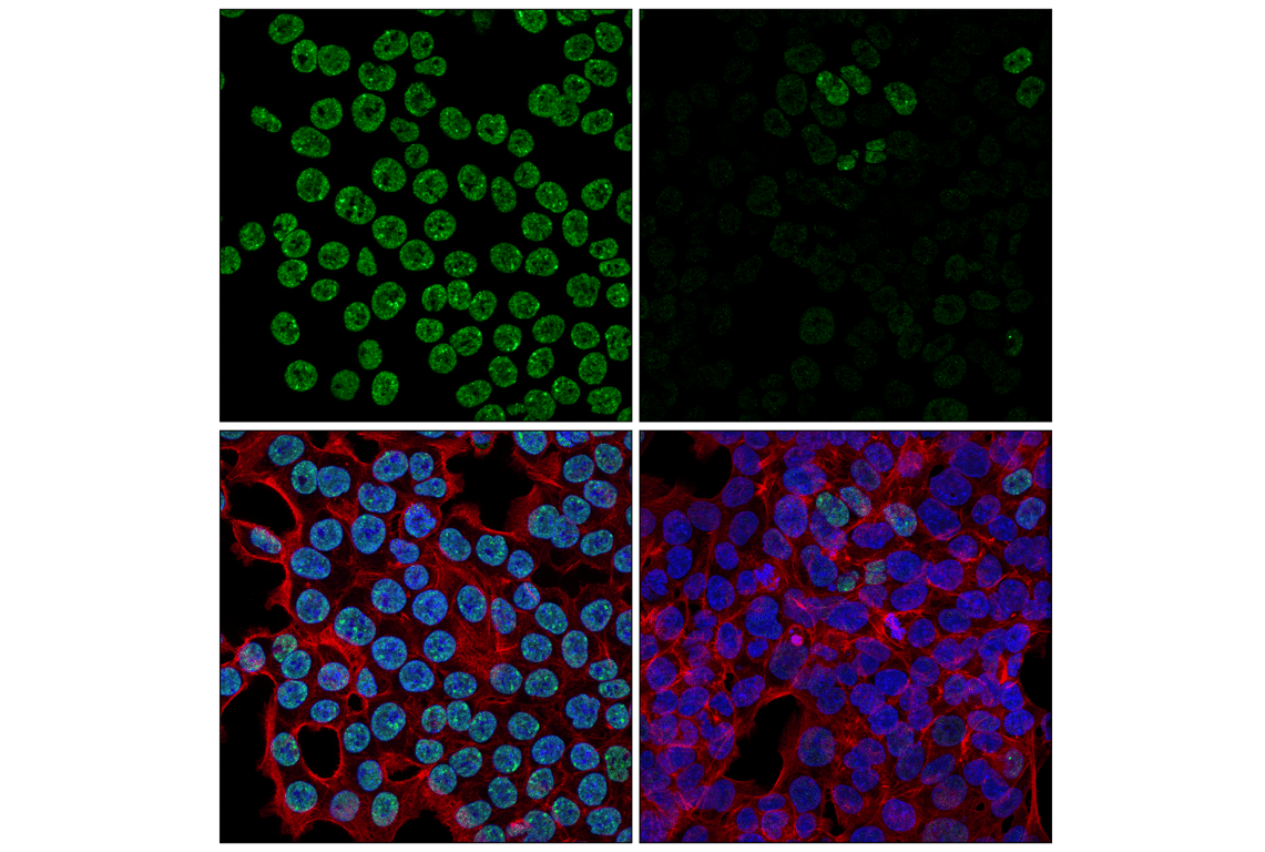 Immunofluorescence Image 2: Matrin 3 (F4Q5F) Rabbit Monoclonal Antibody