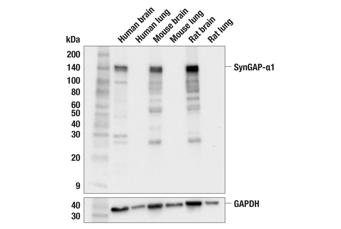 Western Blotting Image 3: SynGAP-alpha1 (F8I5Q) Rabbit Monoclonal Antibody