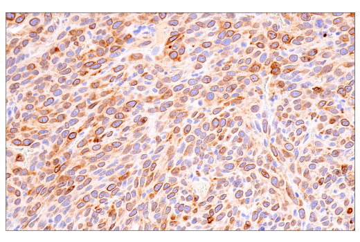 Immunohistochemistry Image 8: Cox2 (D5H5) XP<sup>®</sup> Rabbit mAb (BSA and Azide Free)