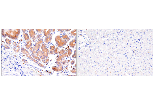 Immunohistochemistry Image 7: Rab27B (E4V3O) Rabbit Monoclonal Antibody