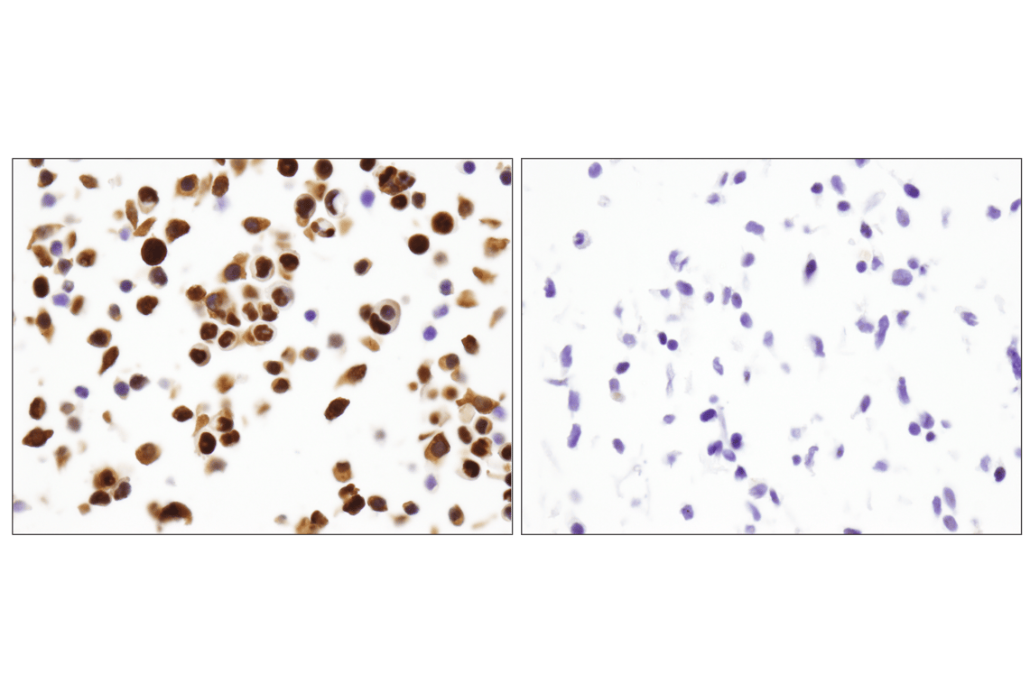 Immunohistochemistry Image 4: p53 (DO-7) Mouse Monoclonal Antibody