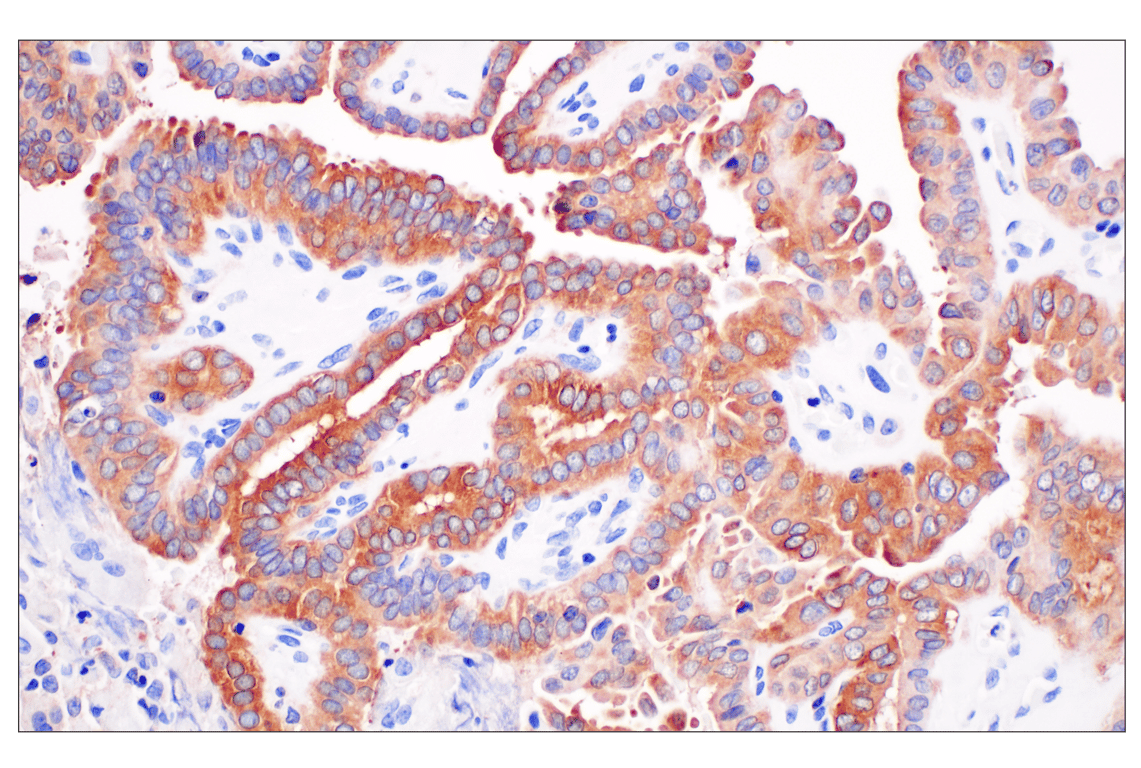 Immunohistochemistry Image 1: SHMT1 (F5Q3S) Rabbit Monoclonal Antibody