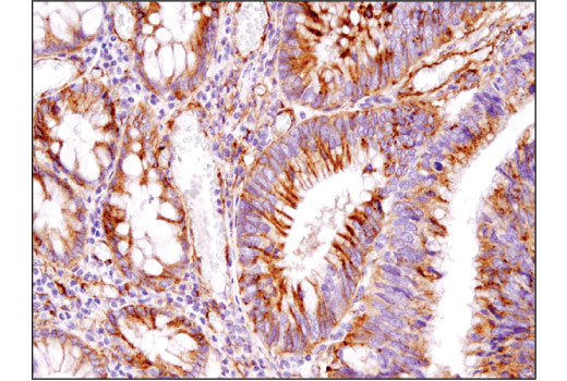 Immunohistochemistry Image 1: IFITM3 (D8E8G) Rabbit Monoclonal Antibody