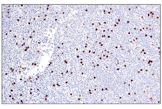 Immunohistochemistry Image 2: Arginase-1 (E4U1I) Mouse Monoclonal Antibody (BSA and Azide Free)