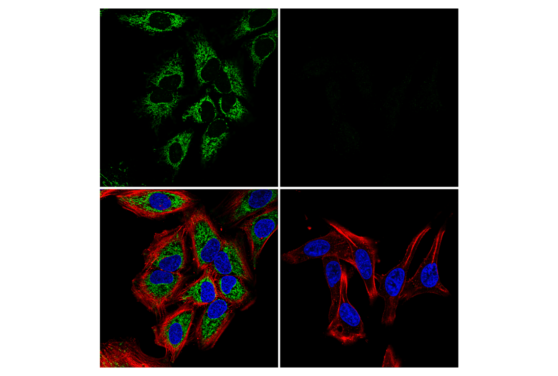 Immunofluorescence Image 1: CPT1A (E3Y1V) Rabbit Monoclonal Antibody