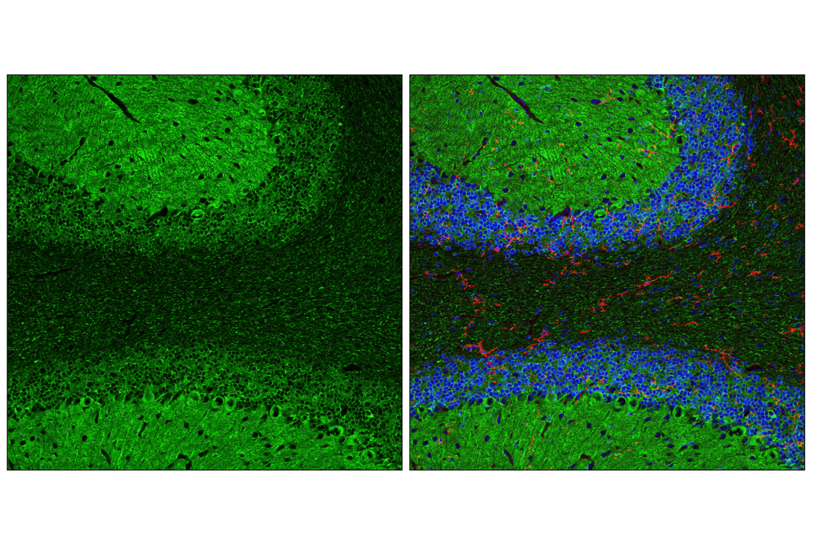 undefined Image 42: Pathological Hallmarks of Alzheimer's Disease Antibody Sampler Kit