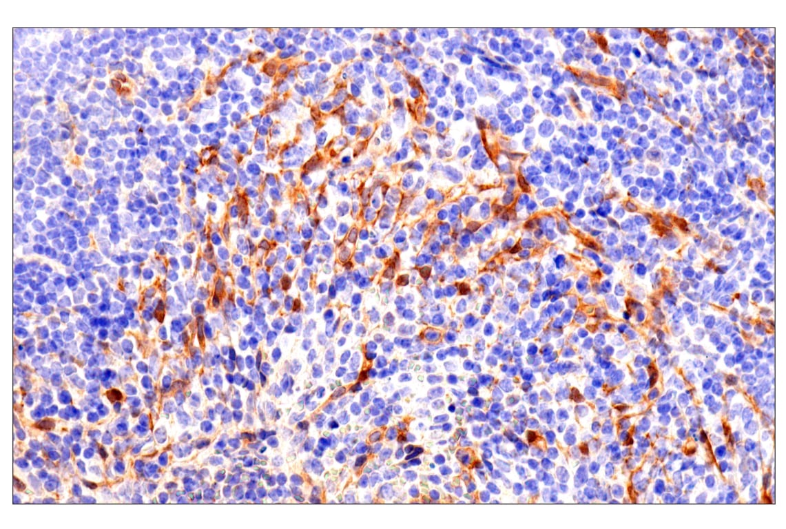 Immunohistochemistry Image 12: Phospho-YAP (Ser61) (E4Q8S) Rabbit Monoclonal Antibody