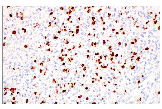 Immunohistochemistry Image 1: MMP-8 (E1C4L) Rabbit Monoclonal Antibody