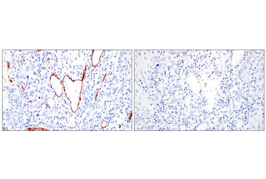Immunohistochemistry Image 10: PLVAP (E3X9D) Rabbit Monoclonal Antibody