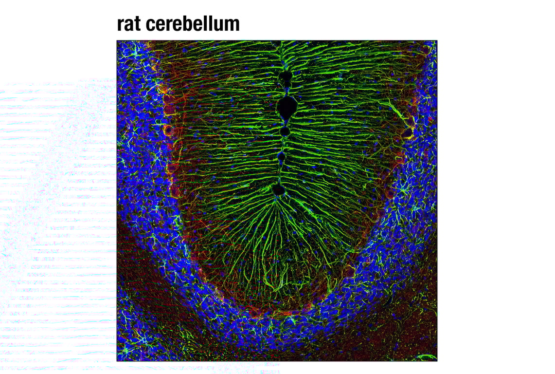 Immunofluorescence Image 1: GFAP (D1F4Q) Rabbit Monoclonal Antibody (BSA and Azide Free)