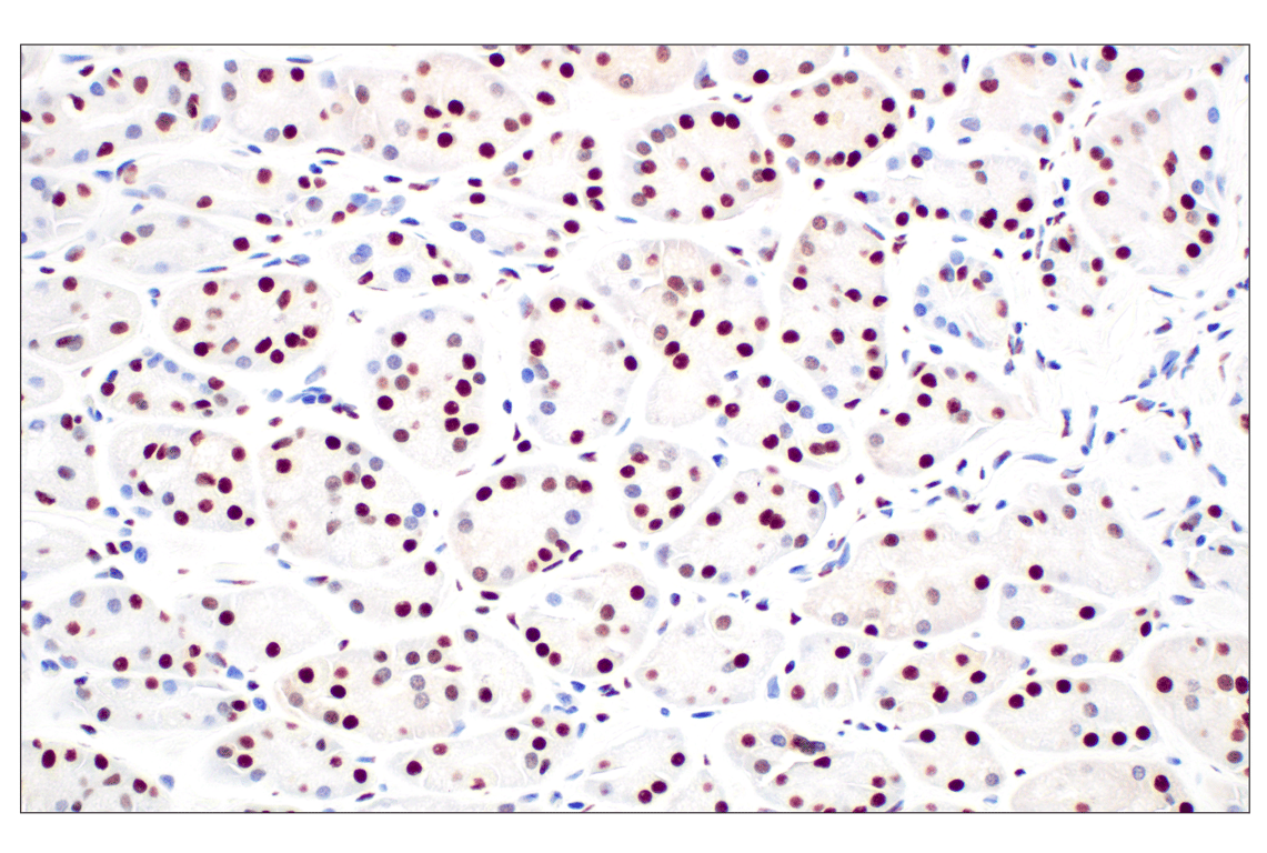 Immunohistochemistry Image 7: CBX7 (E7N1W) Rabbit Monoclonal Antibody