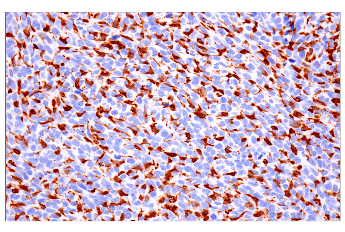 Immunohistochemistry Image 4: p47phox (F3Y6C) Rabbit Monoclonal Antibody