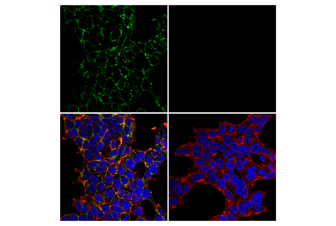 Connexin 43 (E7N2R) XP® Rabbit mAb | Cell Signaling Technology