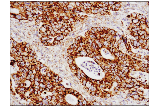 Immunohistochemistry Image 1: SLP-2 (D2I9X) Rabbit Monoclonal Antibody