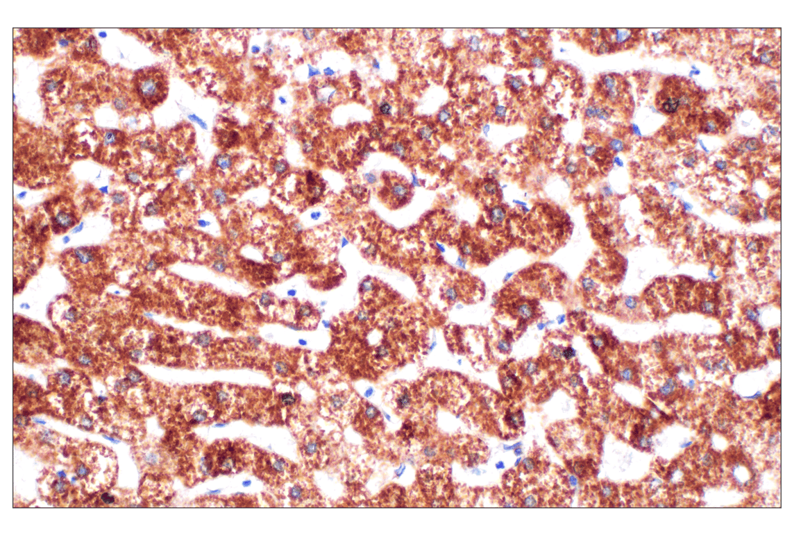 undefined Image 38: Organelle Localization IF Antibody Sampler Kit