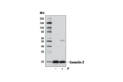 Immunoprecipitation Image 1: Caveolin-2 (D4A6) Rabbit Monoclonal Antibody