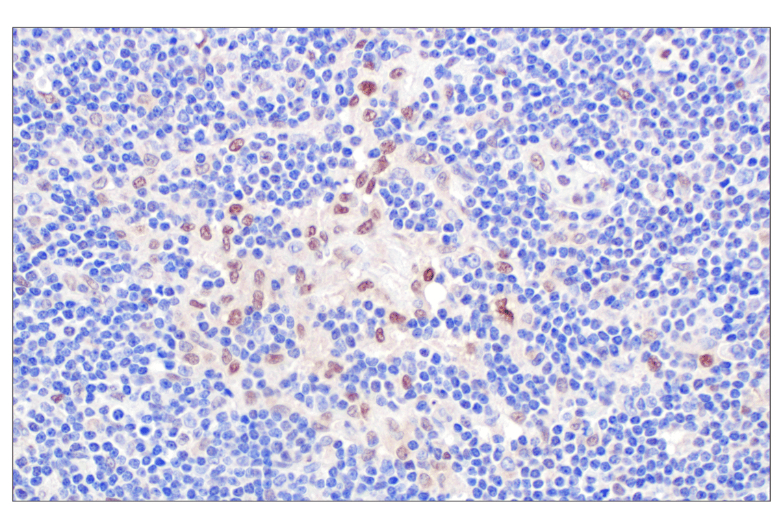 Immunohistochemistry Image 9: TFE3 (F3Z2Q) Rabbit Monoclonal Antibody