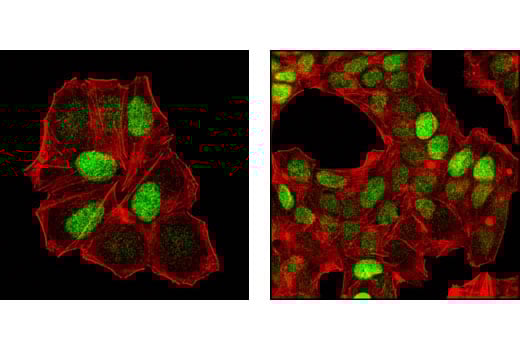 Anti-Ki67 antibody [SP6] (GTX16667) | GeneTex