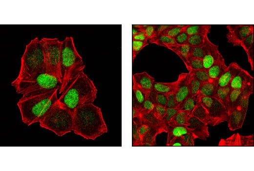 Immunofluorescence Image 1: p27 Kip1 (SX53G8.5) Mouse mAb