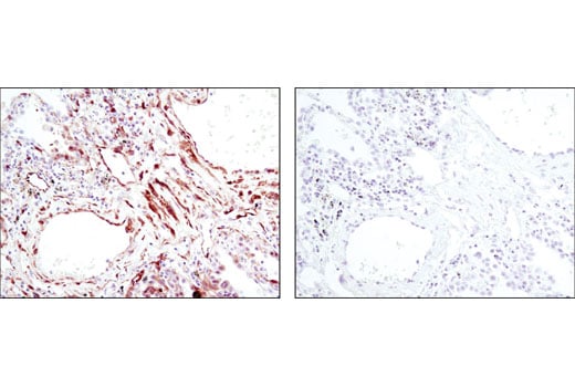 undefined Image 30: Stress and Apoptosis Antibody Sampler Kit