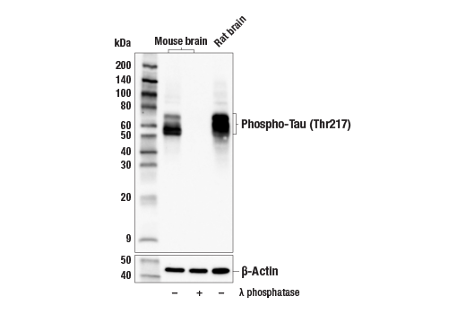 Western Blotting Image 2: Phospho-Tau (Thr217) (E9Y4S) Rabbit Monoclonal Antibody (BSA and Azide Free)
