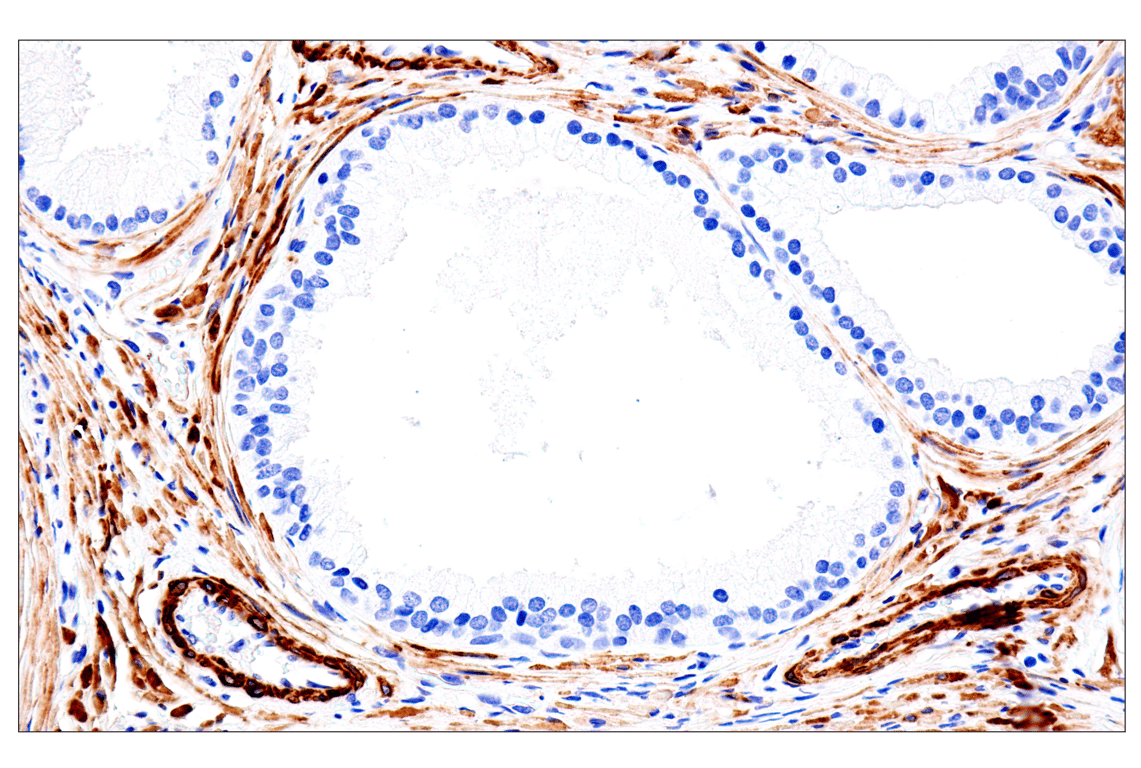Immunohistochemistry Image 6: MYH11 (E4N8M) Rabbit Monoclonal Antibody (BSA and Azide Free)