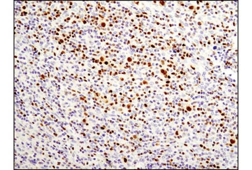 Immunohistochemistry Image 3: T-bet/TBX21 (D6N8B) Rabbit Monoclonal Antibody