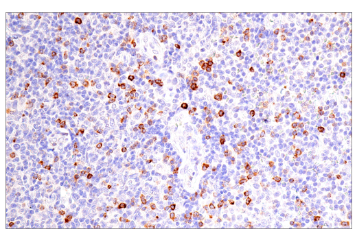 Immunohistochemistry Image 1: CD7 (LP15) Mouse Monoclonal Antibody