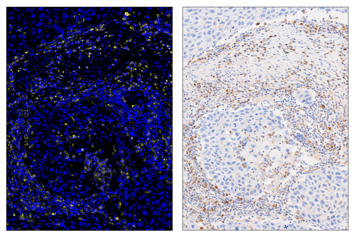 Immunohistochemistry Image 3: VISTA (D1L2G) & CO-0185-647 SignalStar<sup>®</sup> Oligo-Antibody Pair