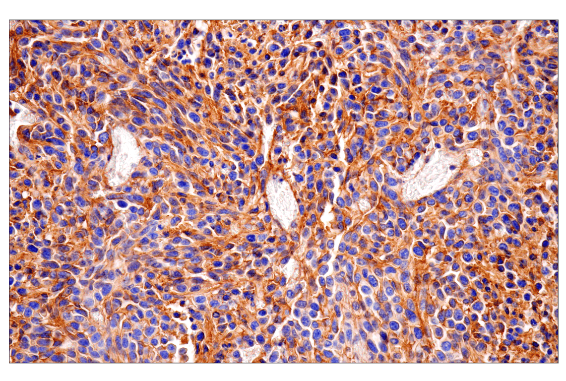 Immunohistochemistry Image 1: CD81 (D5O2Q) Rabbit Monoclonal Antibody