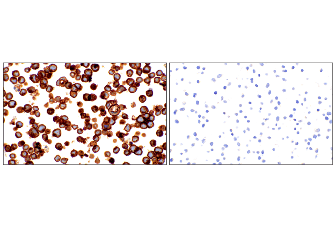 Immunohistochemistry Image 5: FGF Receptor 2IIIb (FPR2-D) Mouse Monoclonal Antibody
