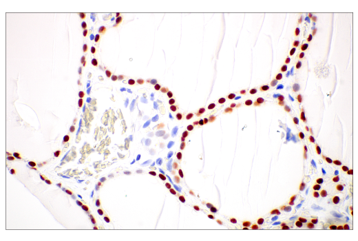 Immunohistochemistry Image 1: Thyroid Transcription Factor 1 (TTF-1) (SPT24) Mouse Monoclonal Antibody