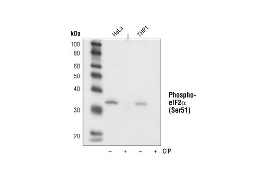 Western Blotting Image 2: Phospho-eIF2 alpha (Ser51) (119A11) Rabbit Monoclonal Antibody (BSA and Azide Free)