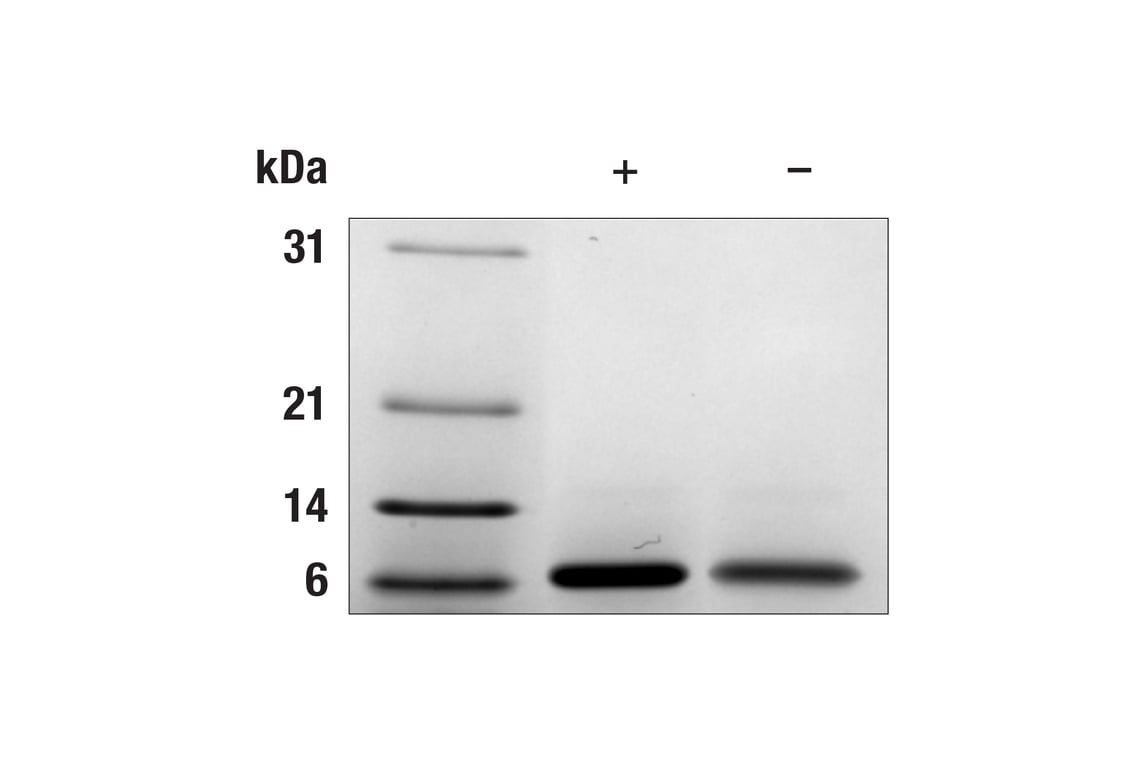 undefined Image 2: Human IGF-I Recombinant Protein