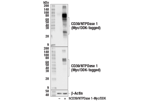 Western Blotting Image 2: CD39/NTPDase 1 (E5A6L) Rabbit Monoclonal Antibody