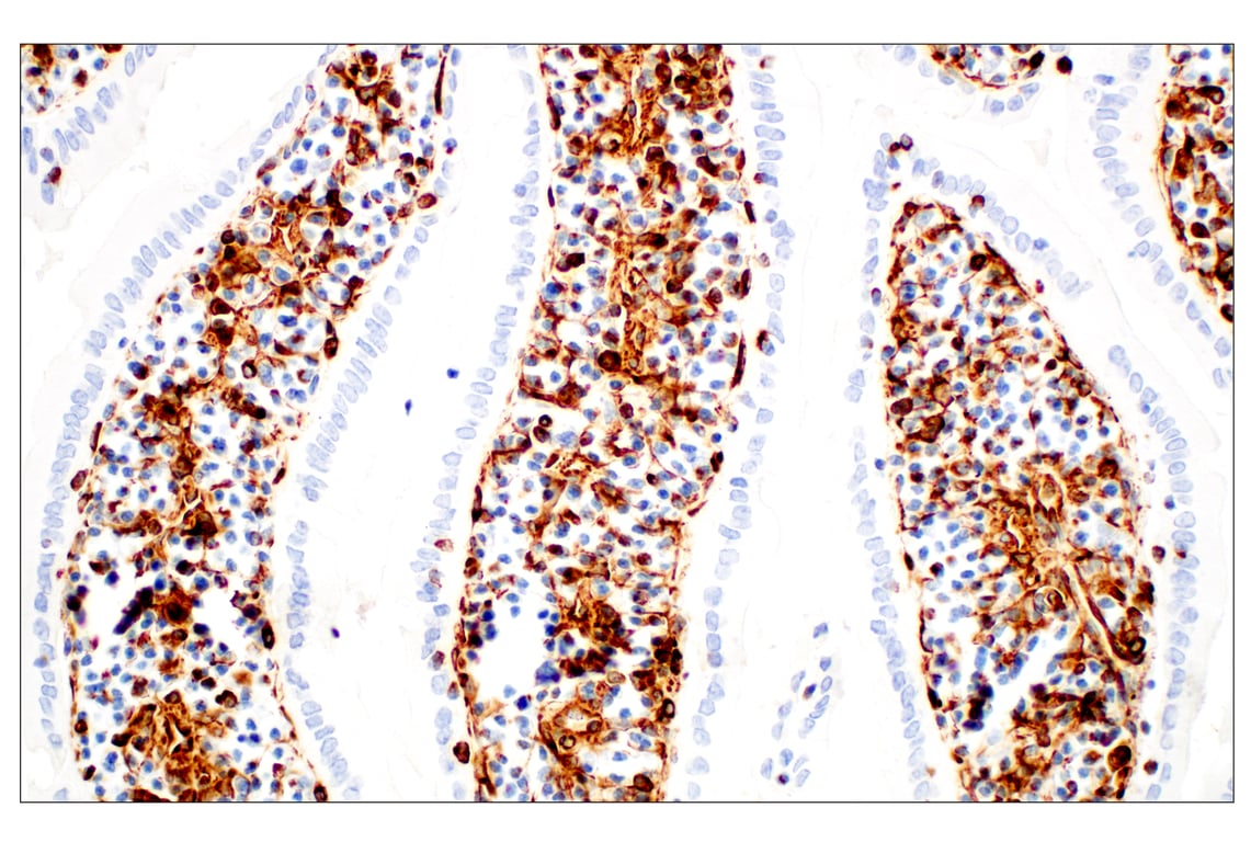 Immunohistochemistry Image 5: Vimentin (D21H3) Rabbit Monoclonal Antibody