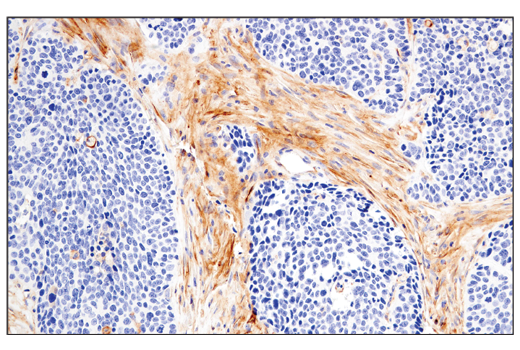 Immunohistochemistry Image 4: CD54/ICAM-1 (E3Q9N) Rabbit Monoclonal Antibody (BSA and Azide Free)
