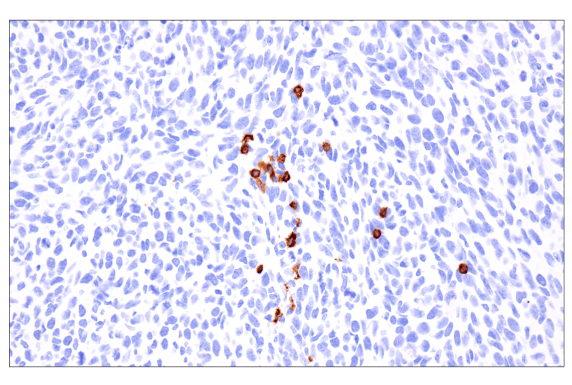 Immunohistochemistry Image 2: CD79A (F3Z1H) Rabbit Monoclonal Antibody