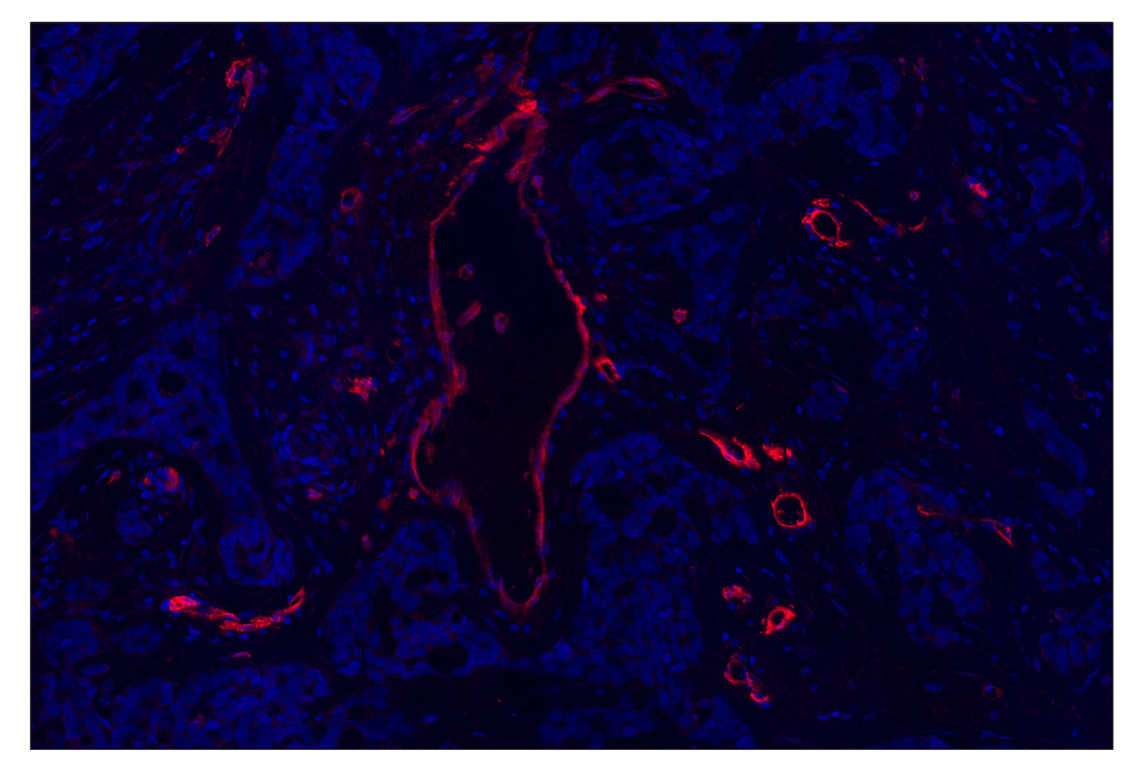 Immunohistochemistry Image 4: CD36 (D8L9T) & CO-0228-750 SignalStar<sup>®</sup> Oligo-Antibody Pair