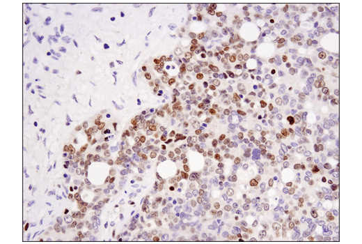 Immunohistochemistry Image 1: DNMT3A (D23G1) Rabbit Monoclonal Antibody