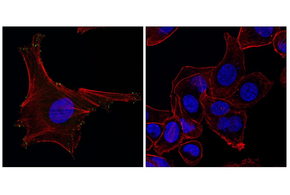 Immunofluorescence Image 1: MYO10 (F3V7U) Rabbit Monoclonal Antibody
