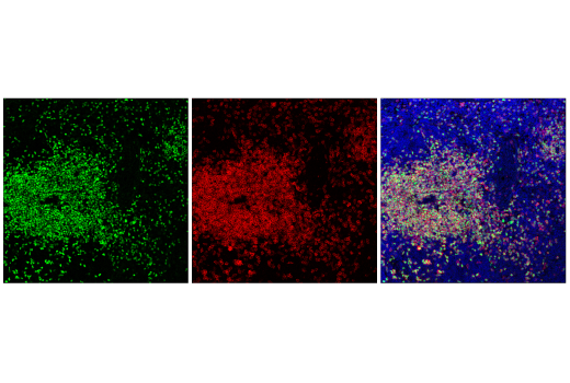 Immunofluorescence Image 2: TCF1/TCF7 (E6O1K) Rabbit Monoclonal Antibody (Alexa Fluor<sup>®</sup> 488 Conjugate)