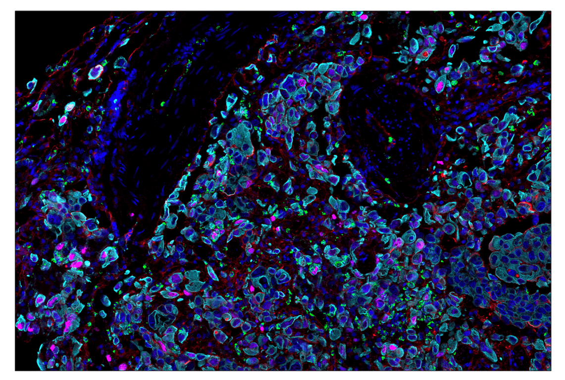 Immunohistochemistry Image 7: Myeloperoxidase (E1E7I) & CO-0138-750 SignalStar<sup>™</sup> Oligo-Antibody Pair