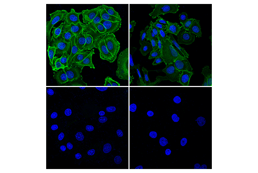 Immunofluorescence Image 1: Glut3 (E7M7V) Rabbit Monoclonal Antibody