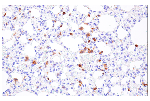 Immunohistochemistry Image 2: NK1.1/CD161 (E6Y9G) Rabbit Monoclonal Antibody (BSA and Azide Free)