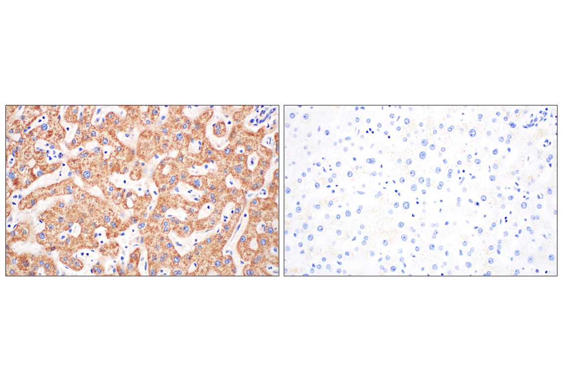 Immunohistochemistry Image 8: GCDH (F2P2M) Rabbit Monoclonal Antibody