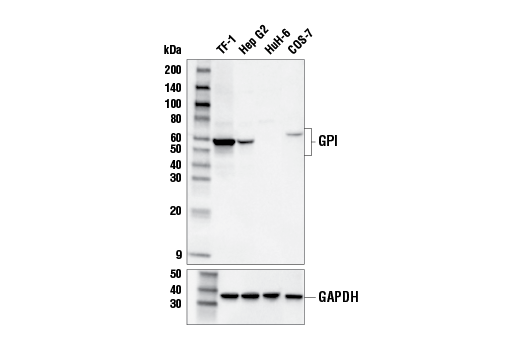 undefined Image 12: Gluconeogenesis Antibody Sampler Kit