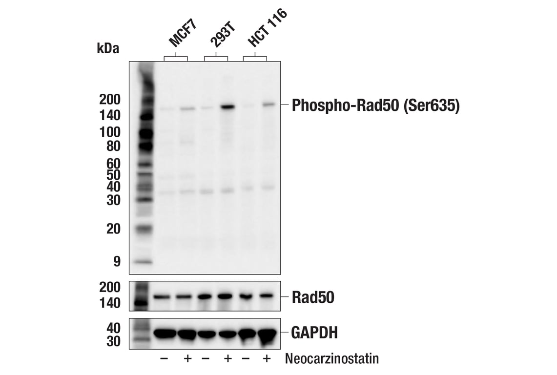 Phospho-Rad50 (Ser635) (F5H8B) Rabbit mAb (#99215) Datasheet