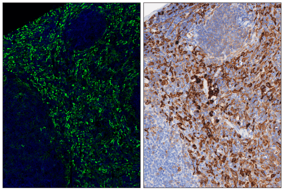 Immunohistochemistry Image 6: CD206/MRC1 (E6T5J) & CO-0032-488 SignalStar<sup>™</sup> Oligo-Antibody Pair